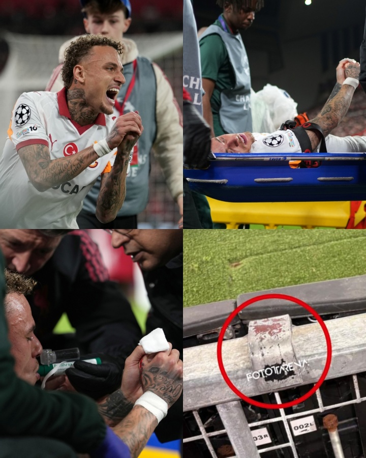 诺阿·朗拇指免于截肢 欧足联介入调查安菲尔德广告牌伤人事件